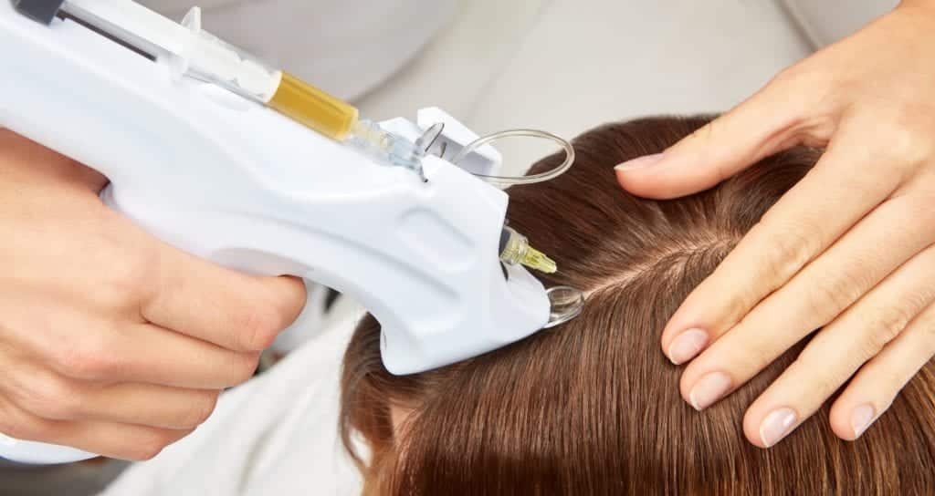 FAD OR FAB? WHAT IS PRP AND WHY IS EVERYONE TALKING ABOUT IT?