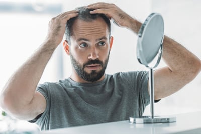 mid adult man with alopecia